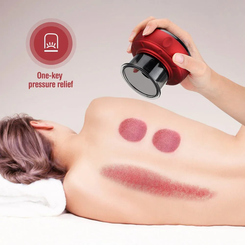 Electric Cupping Massager Set for Cellulite Therapy & Fat Burning - Zentelle Beauty